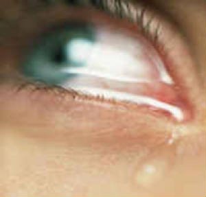 crying+eyes