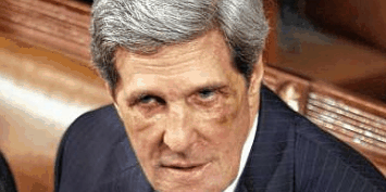 John-Kerry-Black-Eyes